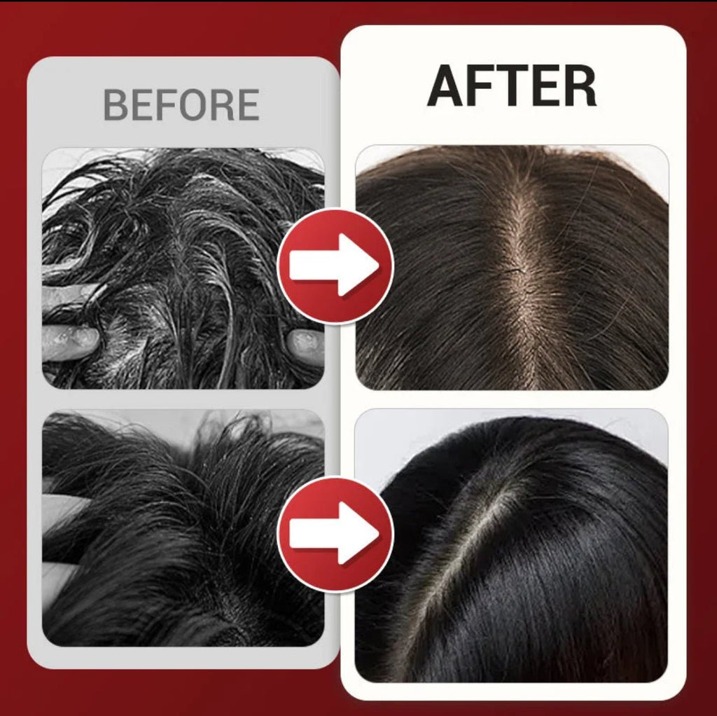 Peigne de Massage électrique à vibrations, thérapie à la lumière rouge, brosse de Massage pour la croissance des cheveux, Anti-perte de cheveux, applicateur d'huile liquide, soins capillaire